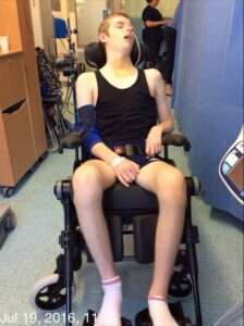 Picture of teenage stroke survivor Ryley